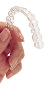 Invisalign in Silver Spring & Germantown, MD